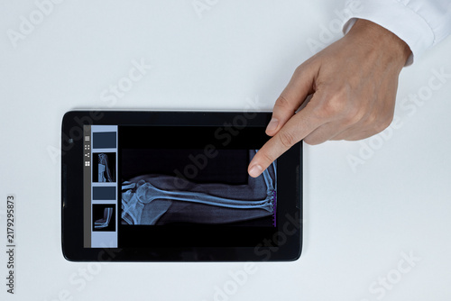 Foto Doctors hand pointing at an arm and elbow bone X-ray scan displayed on a tablet screen
