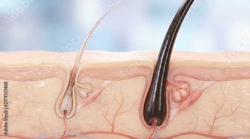 A cross-section illustration showing skin tissue with a grey hair follicle and a dark hair follicle.