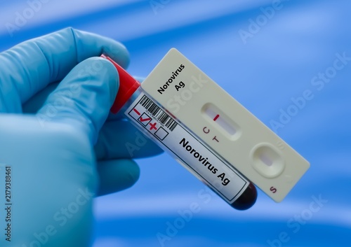 Foto Blood sample of patient negative result for norovirus Ag.