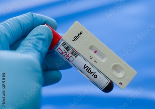 Foto The sample of patient negative result for vibrio.