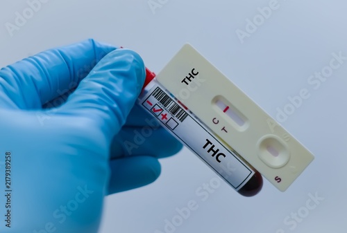 The sample tube of patient negative result for THC.