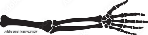 Detailed black silhouette of a human arm and hand skeleton, showing bones of the forearm, wrist, and fingers, on white background