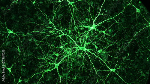 Green fluorescent neuron cells under microscope