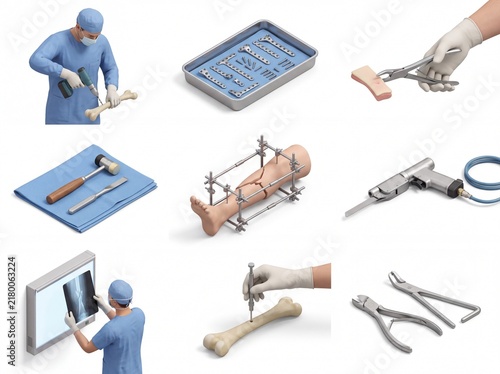Surgeon performing orthopedic bone surgery with various medical tools
