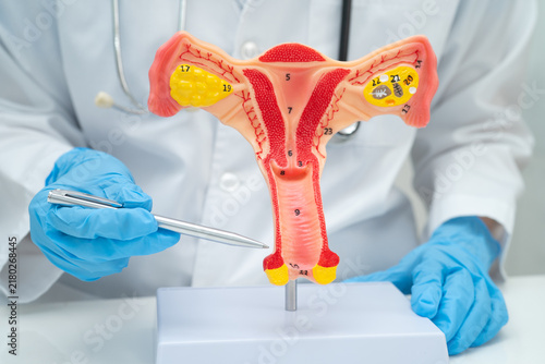 Obraz na płótnie Doctor holding human uterus model for vaginal and cervix pap smear check up in the obstetrics and gynecology