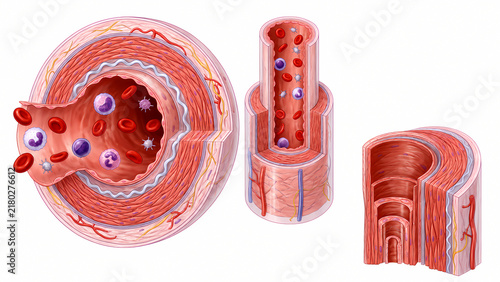 Medical infographic diagrams displaying cross sectional layers of healthy arterial wall and blood cell circulation