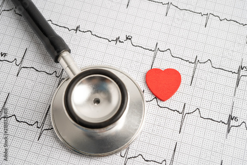 Stethoscope on electrocardiogram ECG, heart wave, heart attack, cardiogram report.