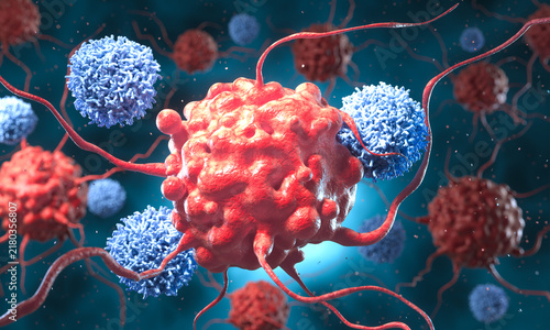 3d Illustration of CAR-T cell therapy showing T-cells attacking cancer cells.