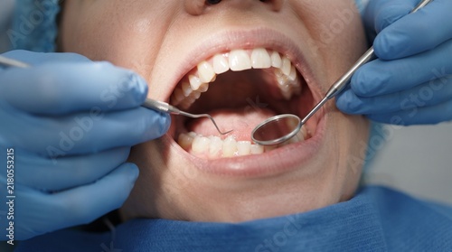 Professional Dental Examination Procedure Showing a Dentist Inspecting Patient Teeth Using Dental Mirror and Explorer Tool for Oral Health Care