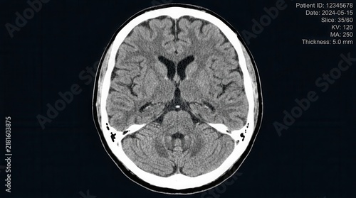 High Resolution Brain Scan Medical Imaging Slice Detailed View