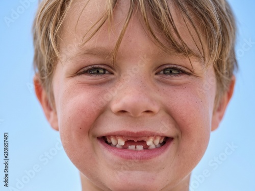 Close up portrait of a happy young boy with a missing front tooth smiling brightly against a clear blue sky background outdoors