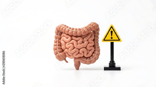 Human intestine model with yellow warning sign for colitis and ibs risk