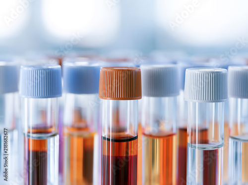 Macro photo of centrifuge tubes with layered biological samples, extreme close-up, bright clinical light, shallow depth of field, orderly close composition with negative space. AI gen