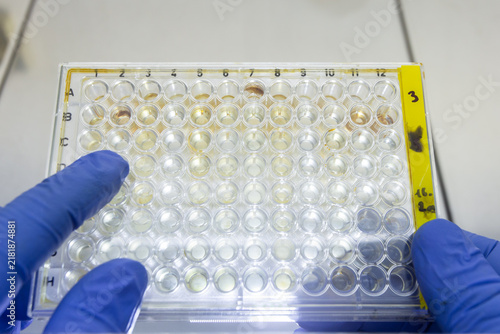 Obraz na płótnie Agglutination reaction of red blood cells to substances secreted by bacteria, which is carried out in an immunological plate with 96 wells
