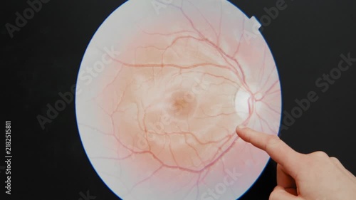 Human hand pointing at printed medical chart of retina eye anatomy during educational session.