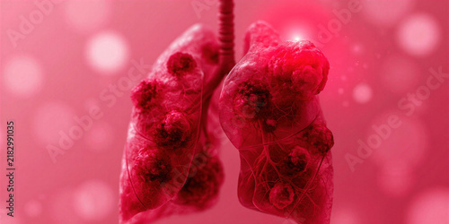 Red Lungs with Tumors: Stylized Medical Illustration of Respiratory Disease for Health Awareness Campaigns