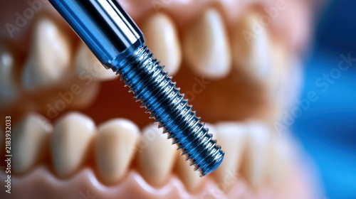 Dental implant screw detail close up macro shot