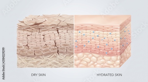 A split view showing the structural differences between dry skin and healthy, hydrated skin cells.