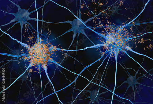 Toxic tau oligomers and neurofibrillary tangles are abnormal accumulations of tau proteins in brain cells that disrupt neuronal function and contribute to the neurodegeneration associated