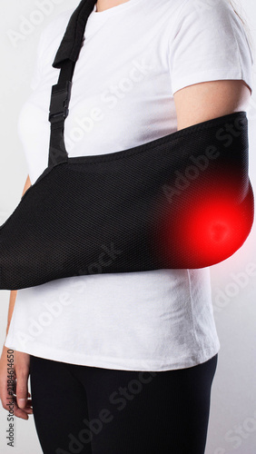 Obraz na płótnie Woman arm in black sling with painful red glow on elbow indicating injury and ne