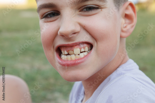 Young boy smiles broadly outdoors
