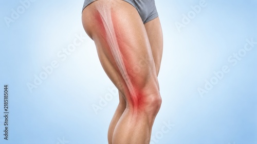 IT band syndrome shown in premium minimal medical CGI with localized outer knee lateral thigh pain along iliotibial band on clean pale blue clinical background.