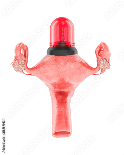 Uterus with red alarm light, gynecology emergency concept, transparent background.