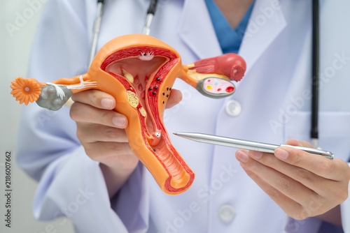 Fotografía Uterus, doctor holding human anatomy model for study diagnosis and treatment in hospital