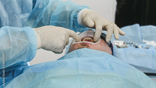 Konstfotografi Dentist placing silicone mouth retractor on patient and examining teeth with den