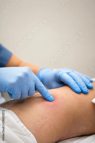 Nurse performing a blanching test for pressure ulcer assessment