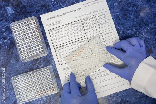 Obraz na płótnie The scientist records the results of the enzyme immunoassay from the immunological plate into the laboratory protocol