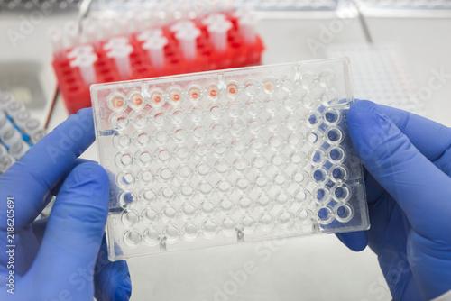 Foto A scientist is analyzing an immunological test for the antibody response to a pathogen using a human blood sample