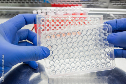 Canvastavla A doctor holds two immunological plates showing agglutination reactions in front of themselves