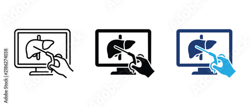 Laparoscopic liver surgery icon set, monitor screen surgeon hand holding instrument linear solid and colored