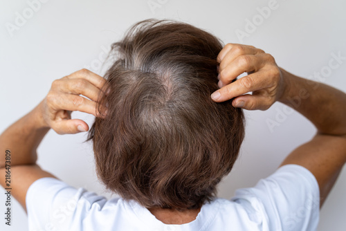 Mature woman touches thinning gray hair, showing visible scalp, hair loss and age-related hair changes on a light background