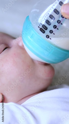 Sleeping infant drinks from bottle in close up, calm and drowsy. Baby bottle feeding continues in medical style, with bottle held at mouth while child rests on white bedding while sucking milk.
