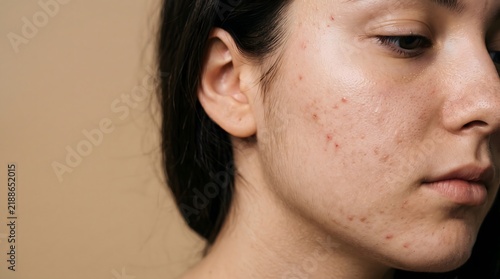 A close-up portrait of a thoughtful young person showing natural skin texture and blemishes.