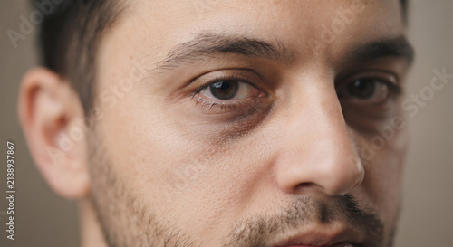 Tired Eyes, Deep Reflection: A close-up portrait captures the weary gaze of a man, his eyes conveying a sense of deep thought and perhaps exhaustion.