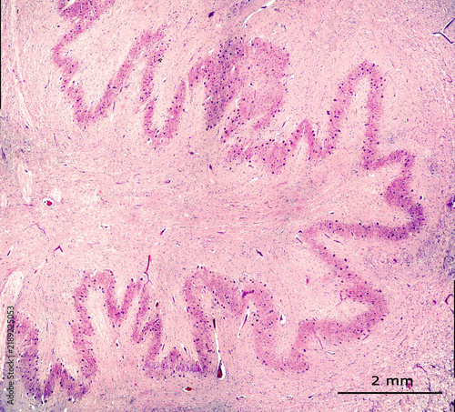 Human inferior olivary nucleus.