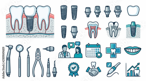 Dental implant, stomatology surgery, and dentistry clinic vector illustration set