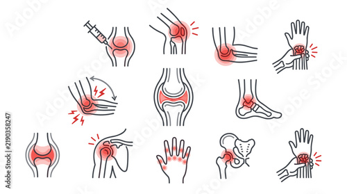 Joint Pain and Inflammation Medical Line Icon Set with Arthritis Injury Symptoms and Red Pain Areas
