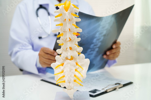 Bild auf Leinwand Doctor examining spine bone radiography xray film.