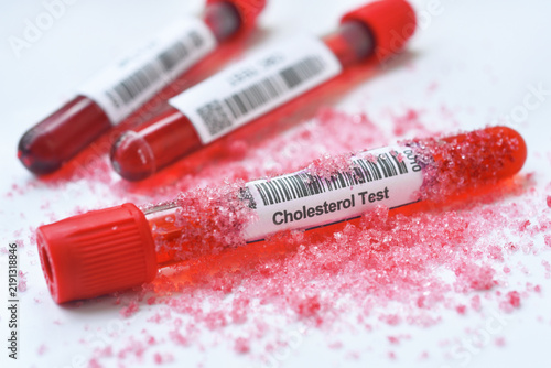 Cholesterol blood tube with sugar.  Blood sugar monitoring sugar metabolism and heart health. Blood tests can help assess glucose levels, lipid profiles, and other important health markers.