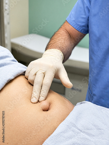 Medical doctor examining a patient with a paraumbilical hernia in clinic