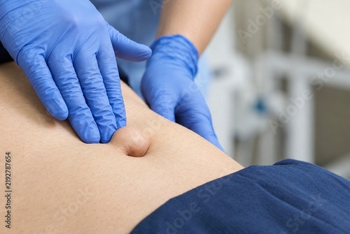 Medical doctor examining a patient with paraumbilical hernia during physical checkup