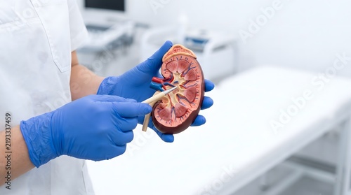A medical professional in blue gloves points to a cross-section model of a human kidney in a clinic.
