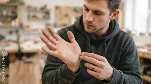 Young Craftsman Examining Small Callus or Skin Lesion on Palm in Workshop