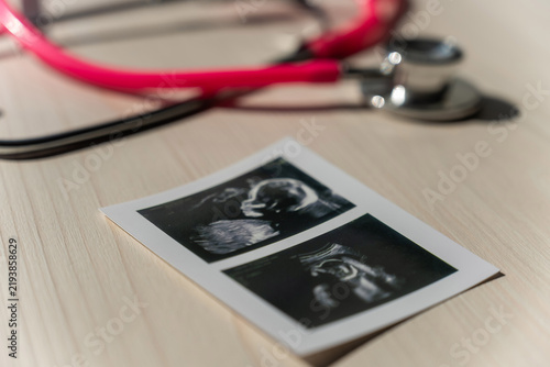 Bild auf Leinwand Photo: Ultrasound screening of a child and stethoscope