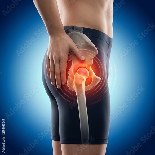 3D Hip Joint Pain Visualization
