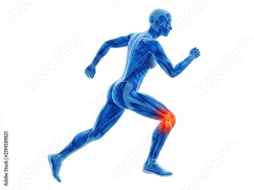 Running human silhouette with glowing knee pain anatomical diagram isolated on transparent background